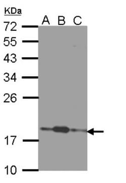 COMMD7 Antibody, Novus Biologicals 0.1mg; Unlabeled:Antibodies, Polyclonal