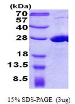 Novus Biologicals&trade;&nbsp;Recombinant Human COMMD7 His Protein