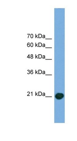 COMMD8 Antibody, Novus Biologicals 20&mu;L; Unlabeled:Antibodies, Polyclonal