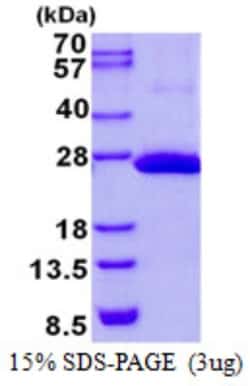 Novus Biologicals&trade;&nbsp;Recombinant Human COMMD9 His Protein