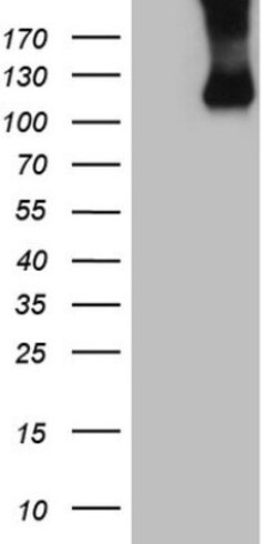 Common beta Chain Antibody (OTI4H3), Novus Biologicals 0.1mL; Unlabeled:Antibodies,