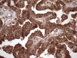 Common beta Chain Antibody (OTI4H3), Novus Biologicals 0.1mL; Unlabeled:Antibodies,
