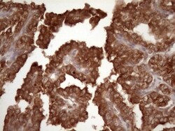 Common beta Chain Antibody (OTI4H3), Novus Biologicals 0.1mL; Unlabeled:Antibodies,