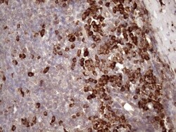 Common beta Chain Antibody (OTI4H3), Novus Biologicals 0.1mL; Unlabeled:Antibodies,