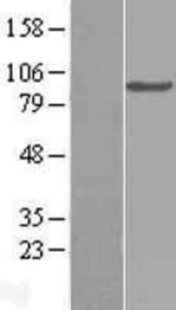 Novus Biologicals&trade;&nbsp;Complement Component C2 Overexpression Lysate