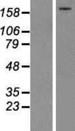 Novus Biologicals&trade;&nbsp;Complement C5 Overexpression Lysate