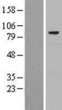 Novus Biologicals&trade;&nbsp;Complement C7 Overexpression Lysate