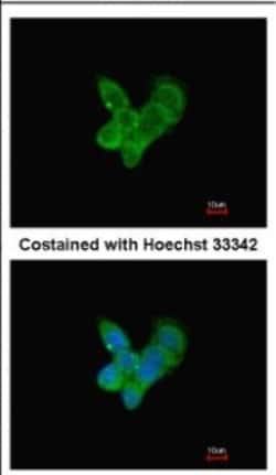 Complement Component C9 Antibody, Novus Biologicals 0.1mL; Unlabeled:Antibodies,