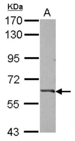 Complement Component C9 Antibody, Novus Biologicals 0.1mL; Unlabeled:Antibodies,