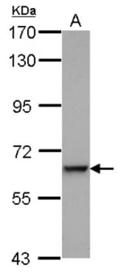 Complement Component C9 Antibody, Novus Biologicals 0.1mL; Unlabeled:Antibodies,