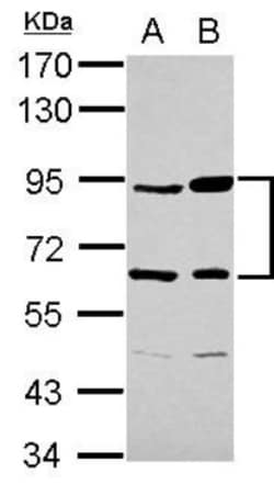 Complement Factor B Antibody, Novus Biologicals 0.1mL; Unlabeled:Antibodies,