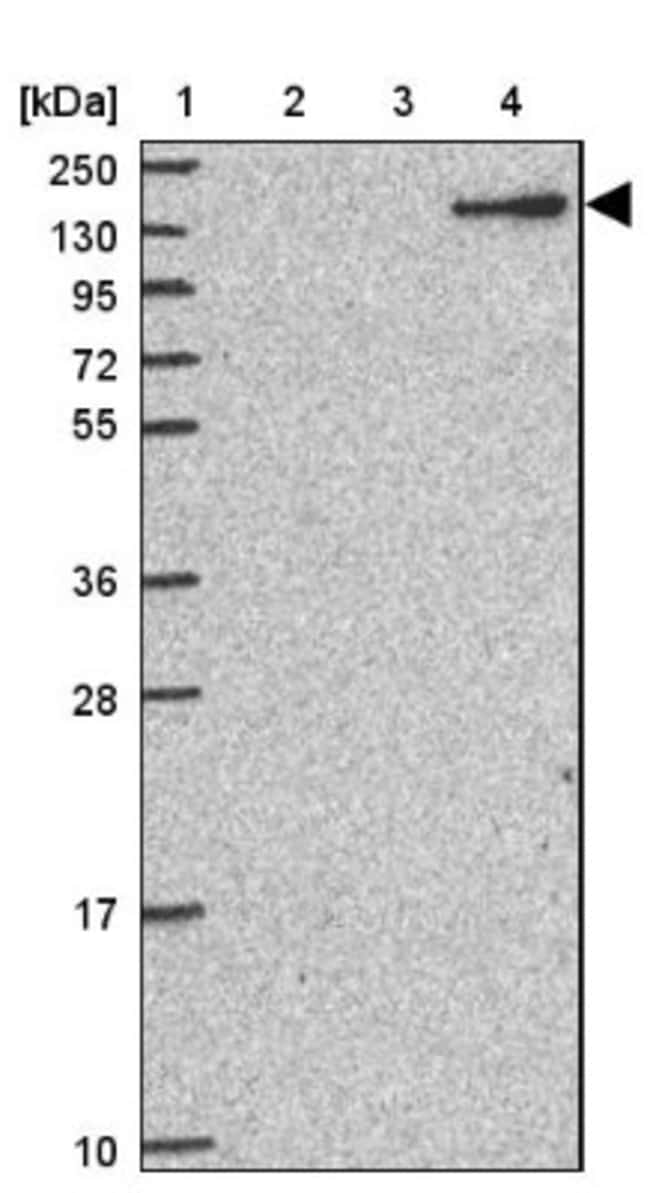 COMPLEMENT FACTOR H 0 1 ML Complement factor h 0 1 ml