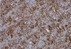 Complement C3 Antibody, Novus Biologicals 100 &mu;L | Buy Online | Novus Biologicals | Fisher Scientific