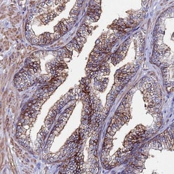 Complement C6 Antibody, Novus Biologicals 0.1 mL | Buy Online | Novus Biologicals | Fisher Scientific