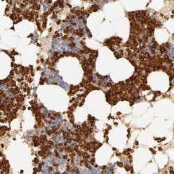 Complement Component C1r Antibody, Novus Biologicals 0.1mL; Unlabeled:Antibodies,