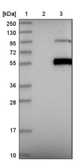 Complement Component C1r Antibody, Novus Biologicals 0.1mL; Unlabeled:Antibodies,
