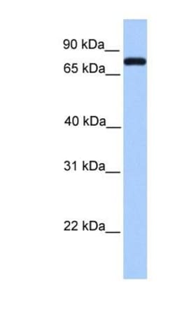 Complement Component C2 Antibody, Novus Biologicals:Antibodies:Primary