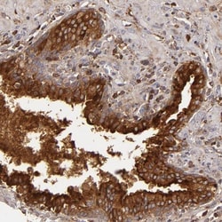Complement Factor B Antibody, Novus Biologicals 0.1mL; Unlabeled:Antibodies,