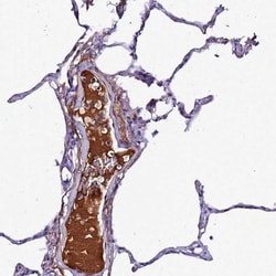 Complement Factor H-related 1/CFHR1/CFHL1 Antibody, Novus Biologicals 0.1mL;