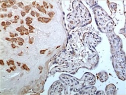 Complement Factor MASP3 Antibody (MM0197-4F19) - Azide and BSA Free, Novus