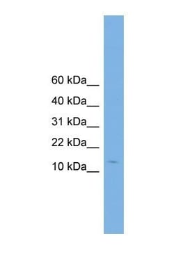 Complexin-2 Antibody, Novus Biologicals 100&mu;L; Unlabeled:Antibodies,