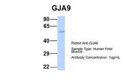 Connexin 58/GJA9 Antibody, Novus Biologicals 100&mu;L; Unlabeled:Antibodies,