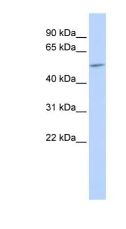 Connexin 58/GJA9 Antibody, Novus Biologicals 100&mu;L; Unlabeled:Antibodies,