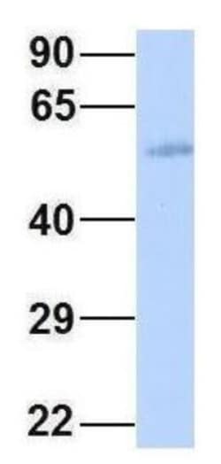 Connexin 58/GJA9 Antibody, Novus Biologicals 100&mu;L; Unlabeled:Antibodies,