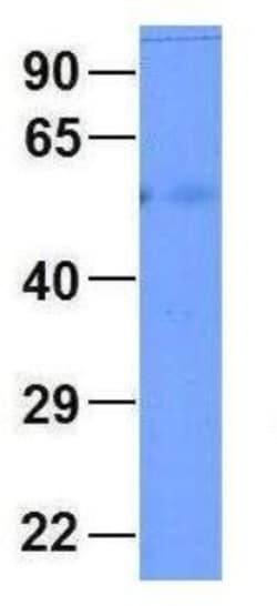 Connexin 58/GJA9 Antibody, Novus Biologicals 100&mu;L; Unlabeled:Antibodies,