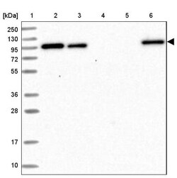 COPG Antibody, Novus Biologicals:Antibodies:Primary Antibodies