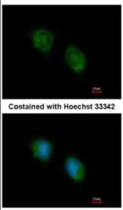 COPS4 Antibody, Novus Biologicals 0.1mL; Unlabeled:Antibodies, Polyclonal