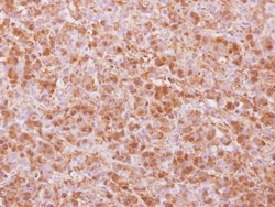 COPS4 Antibody, Novus Biologicals 0.1mL; Unlabeled:Antibodies, Polyclonal