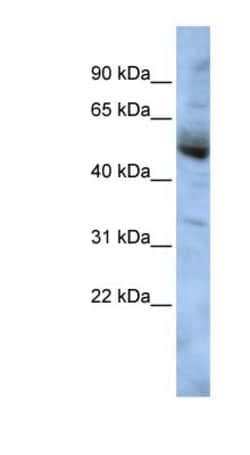 COPS4 Antibody, Novus Biologicals 100&mu;L; Unlabeled:Antibodies, Polyclonal