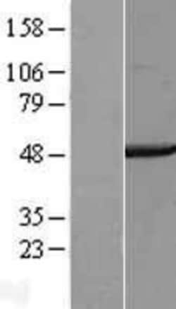Novus Biologicals&trade;&nbsp;COPS4 Overexpression Lysate