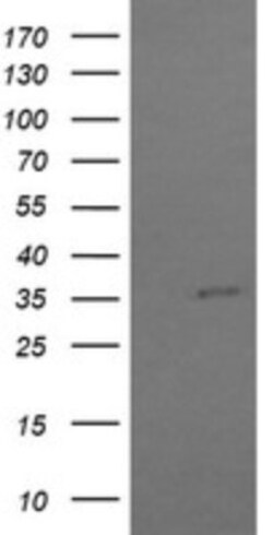 COPS6 Antibody (OTI4E7), Novus Biologicals 0.1mL; Unlabeled:Antibodies,