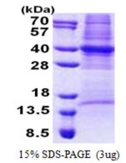 Novus Biologicals&trade;&nbsp;Recombinant Human COPS6 His Protein
