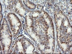 COPS6 Antibody (OTI4E7), Novus Biologicals 0.1mL; Unlabeled:Antibodies,