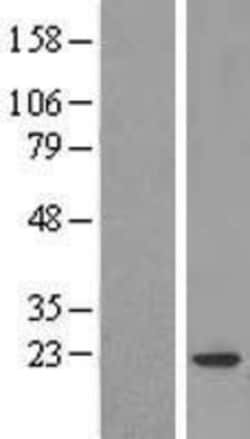 Novus Biologicals&trade;&nbsp;COPZ1 Overexpression Lysate