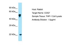 COQ7 Antibody, Novus Biologicals 100&mu;L; Unlabeled:Antibodies, Polyclonal