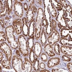 COQ9 Antibody, Novus Biologicals 0.1mL; Unlabeled:Antibodies, Polyclonal