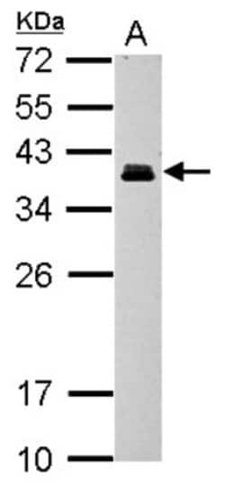 CRX/CORD2 Antibody, Novus Biologicals 0.1mL; Unlabeled:Antibodies, Polyclonal