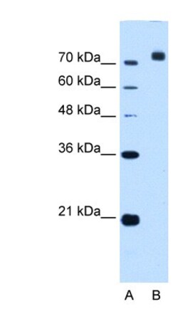 Corin Antibody, Novus Biologicals 0.1mg; Unlabeled:Antibodies, Polyclonal