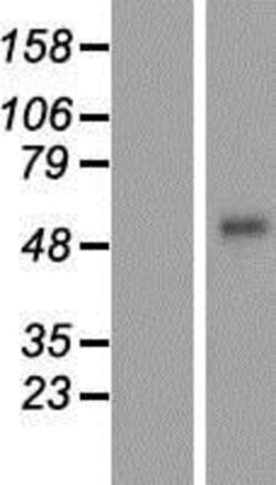Novus Biologicals™ Corneodesmosin Overexpression Lysate