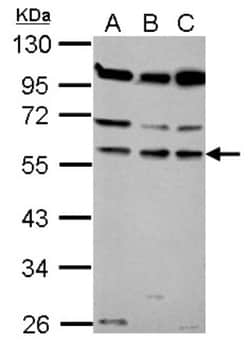CORO1B Antibody, Novus Biologicals 0.1mL; Unlabeled:Antibodies, Polyclonal