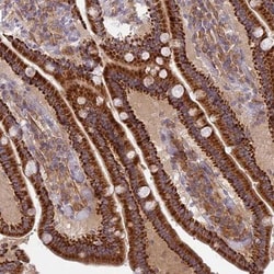 CORO7 Antibody, Novus Biologicals 25 &mu;L, Unlabeled:Antibodies, Polyclonal