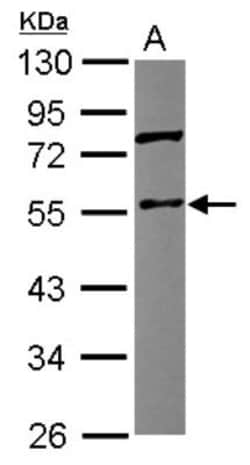 Coronin 3 Antibody, Novus Biologicals 0.1 mL | Buy Online | Novus Biologicals | Fisher Scientific