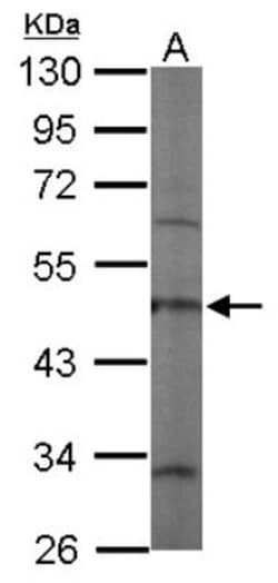 Coronin 3 Antibody, Novus Biologicals 0.1 mL | Buy Online | Novus Biologicals | Fisher Scientific