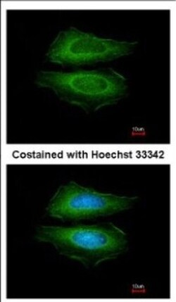 Cortactin Antibody, Novus Biologicals 0.1mL; Unlabeled:Antibodies, Polyclonal