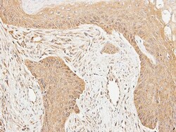 Cortactin Antibody, Novus Biologicals 0.1mL; Unlabeled:Antibodies, Polyclonal
