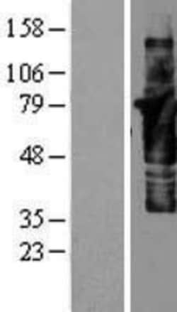Novus Biologicals&trade;&nbsp;Cortactin Overexpression Lysate